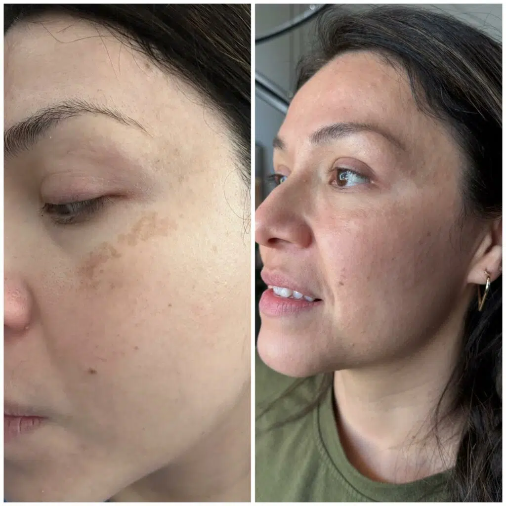 Olive Rose Before and After